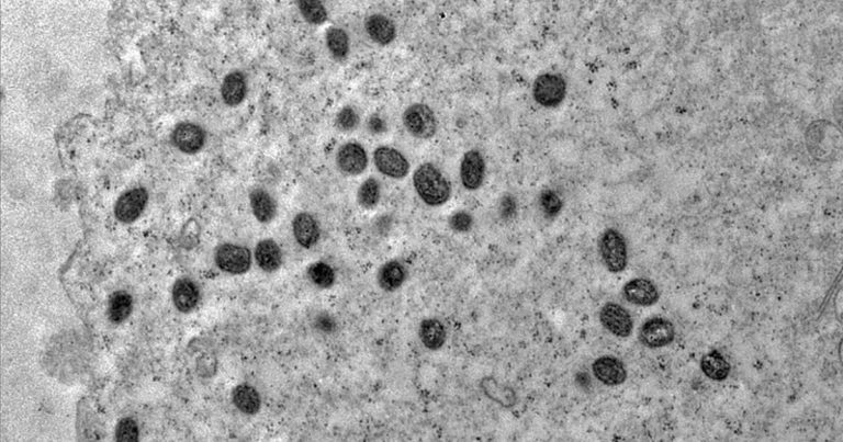 Mpox não é motivo de alerta, diz Ministério da Saúde após 140 casos no Brasil em 2026 mpox-nao-e-motivo-de-alerta,-diz-ministerio-da-saude-apos-140-casos-no-brasil-em-2026