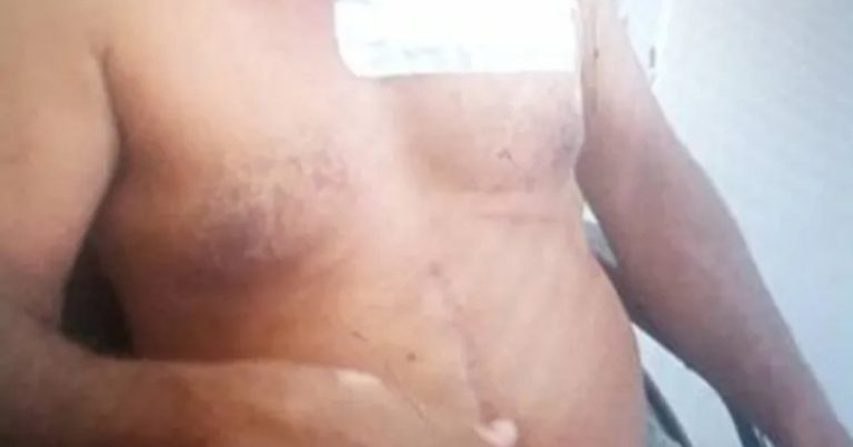 Homem é esfaqueado no tórax em município do Sertão Produtivo homem-e-esfaqueado-no-torax-em-municipio-do-sertao-produtivo