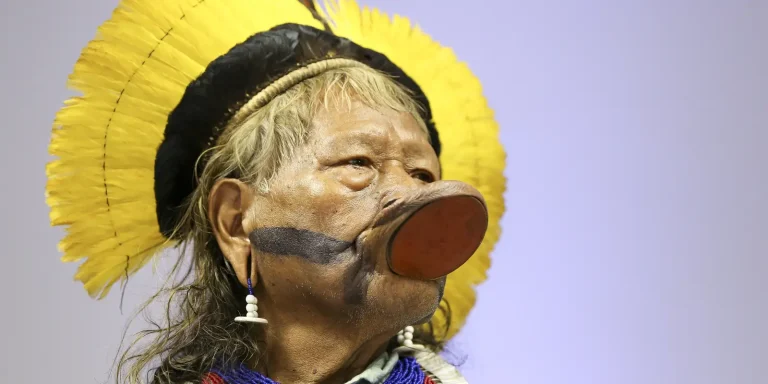 Internado, cacique Raoni tem saúde estável e respira sem aparelhos internado,-cacique-raoni-tem-saude-estavel-e-respira-sem-aparelhos