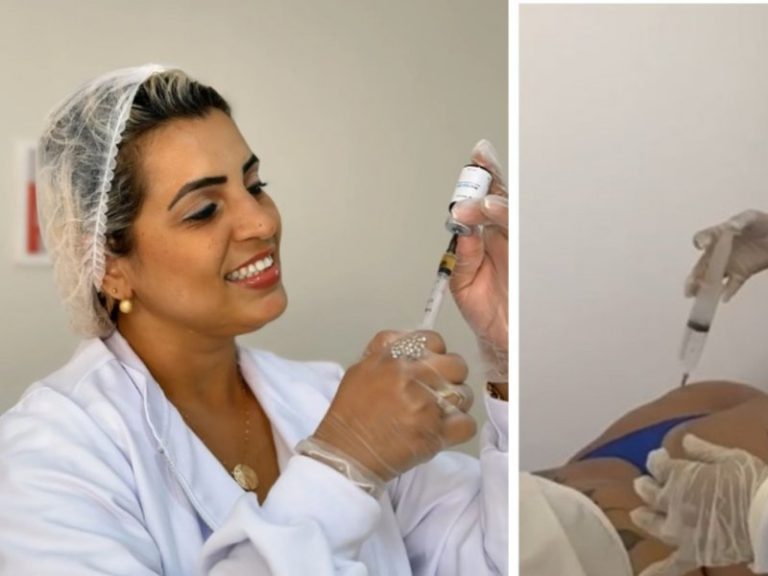 falsa-medica-e-presa-apos-suposto-uso-de-silicone-de-construcao-em-harmonizacao-de-gluteos