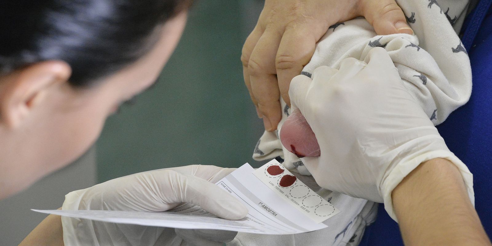 atraso-na-ampliacao-do-teste-do-pezinho-dificulta-diagnostico-da-ame